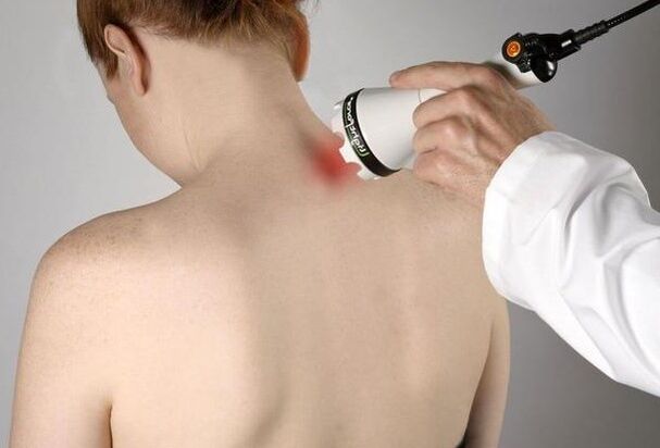 Laser therapy